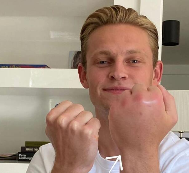 盘点足坛之中最离奇的十大受伤